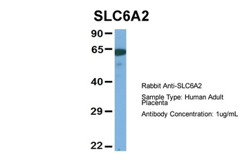 SLC6A2 Rabbit Polyclonal Antibody