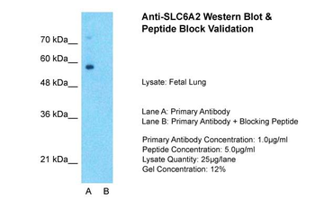 SLC6A2 Rabbit Polyclonal Antibody