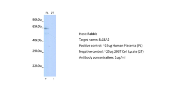 SLC6A2 Rabbit Polyclonal Antibody