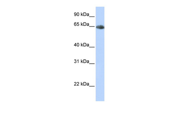 SLC6A2 Rabbit Polyclonal Antibody