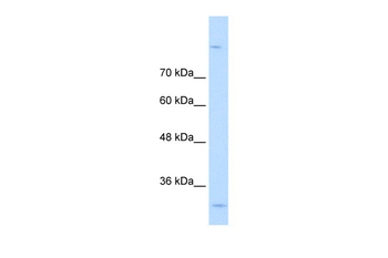 MPPED2 Rabbit Polyclonal Antibody