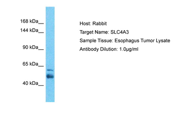 SLC4A3 Rabbit Polyclonal Antibody