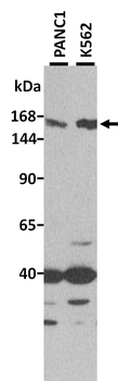CEMIP2 Rabbit Polyclonal Antibody