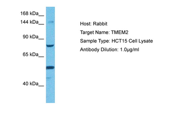CEMIP2 Rabbit Polyclonal Antibody