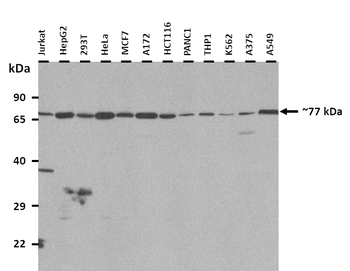 TMCC2 Rabbit Polyclonal Antibody