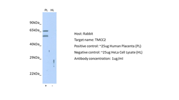 TMCC2 Rabbit Polyclonal Antibody
