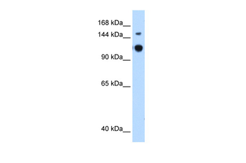GAPVD1 Rabbit Polyclonal Antibody