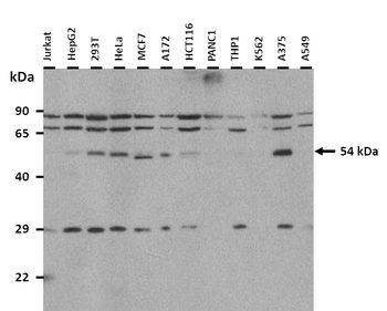 CRNN Rabbit Polyclonal Antibody