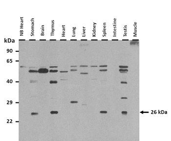 Cbr2 Rabbit Polyclonal Antibody