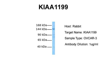 CEMIP Rabbit Polyclonal Antibody