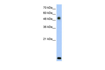 RSAD2 Rabbit Polyclonal Antibody