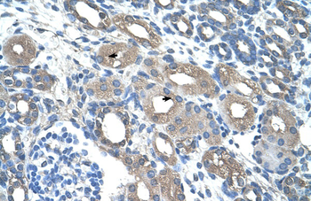 RSAD2 Rabbit Polyclonal Antibody