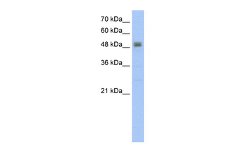 RSAD2 Rabbit Polyclonal Antibody
