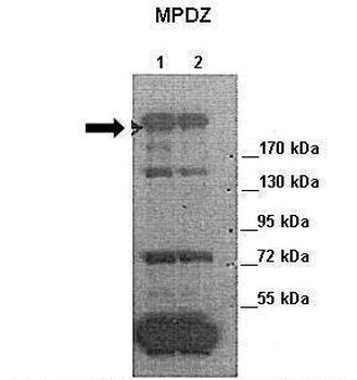 MPDZ Rabbit Polyclonal Antibody