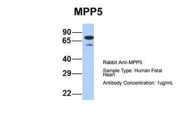 MPP5 Rabbit Polyclonal Antibody