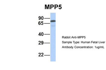 MPP5 Rabbit Polyclonal Antibody