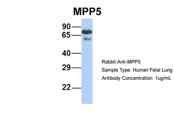 MPP5 Rabbit Polyclonal Antibody