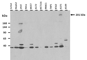 ZNF294 Rabbit Polyclonal Antibody