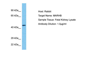 MARCH11 Rabbit Polyclonal Antibody