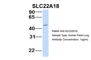 SLC22A18 Rabbit Polyclonal Antibody