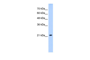 SLC25A14 Rabbit Polyclonal Antibody