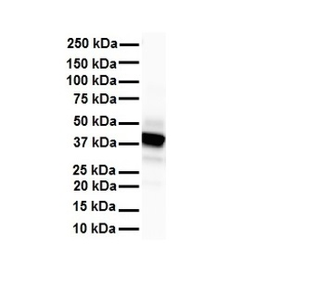 SLC6A5 Rabbit Polyclonal Antibody