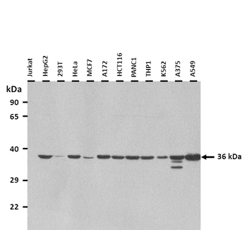 SLC35A3 Rabbit Polyclonal Antibody