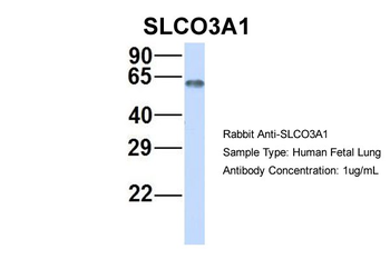 SLCO3A1 Rabbit Polyclonal Antibody