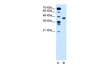 SLC35C1 Rabbit Polyclonal Antibody