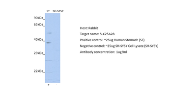 SLC25A28 Rabbit Polyclonal Antibody