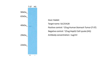 SLC25A28 Rabbit Polyclonal Antibody