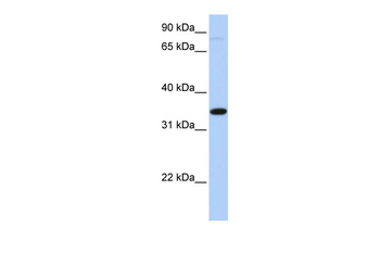 SLC44A3 Rabbit Polyclonal Antibody