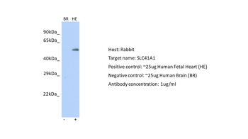 SLC41A1 Rabbit Polyclonal Antibody