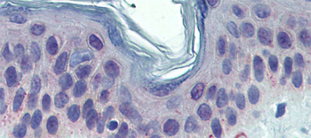 TYRP1 Rabbit Polyclonal Antibody