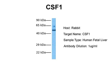 CSF1 Rabbit Polyclonal Antibody
