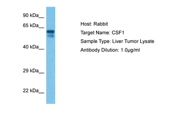 CSF1 Rabbit Polyclonal Antibody