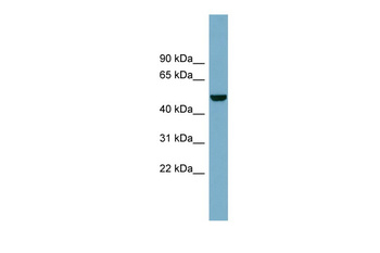 CSF1 Rabbit Polyclonal Antibody