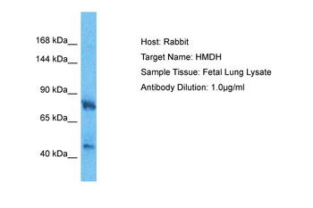 HMGCR Rabbit Polyclonal Antibody