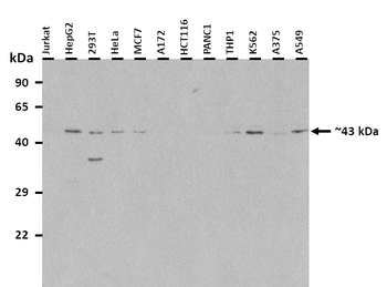 TM6SF2 Rabbit Polyclonal Antibody