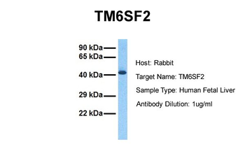 TM6SF2 Rabbit Polyclonal Antibody