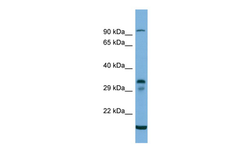 TM6SF2 Rabbit Polyclonal Antibody