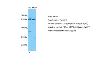 TM6SF2 Rabbit Polyclonal Antibody