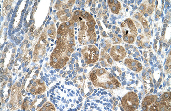 C6orf21 Rabbit Polyclonal Antibody
