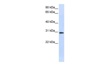 C6orf21 Rabbit Polyclonal Antibody