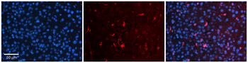 OSBPL8 Rabbit Polyclonal Antibody