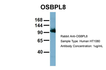 OSBPL8 Rabbit Polyclonal Antibody