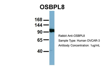 OSBPL8 Rabbit Polyclonal Antibody