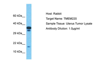 TMEM220 Rabbit Polyclonal Antibody