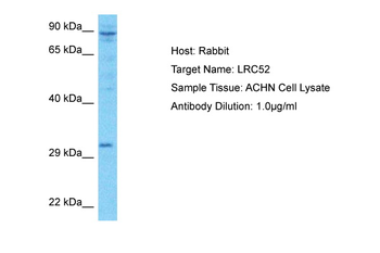 LRRC52 Rabbit Polyclonal Antibody