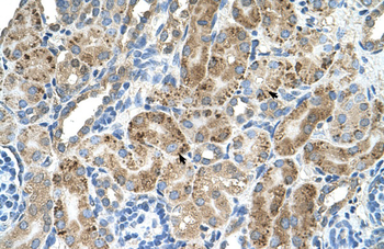 VMA21 Rabbit Polyclonal Antibody